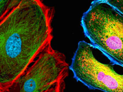 無(wú)自發(fā)熒光，成像效果佳，可用于熒光顯微實(shí)驗(yàn)、激光共聚焦顯微實(shí)驗(yàn)、熒光原位雜交（FISH）和相差顯微實(shí)驗(yàn)等